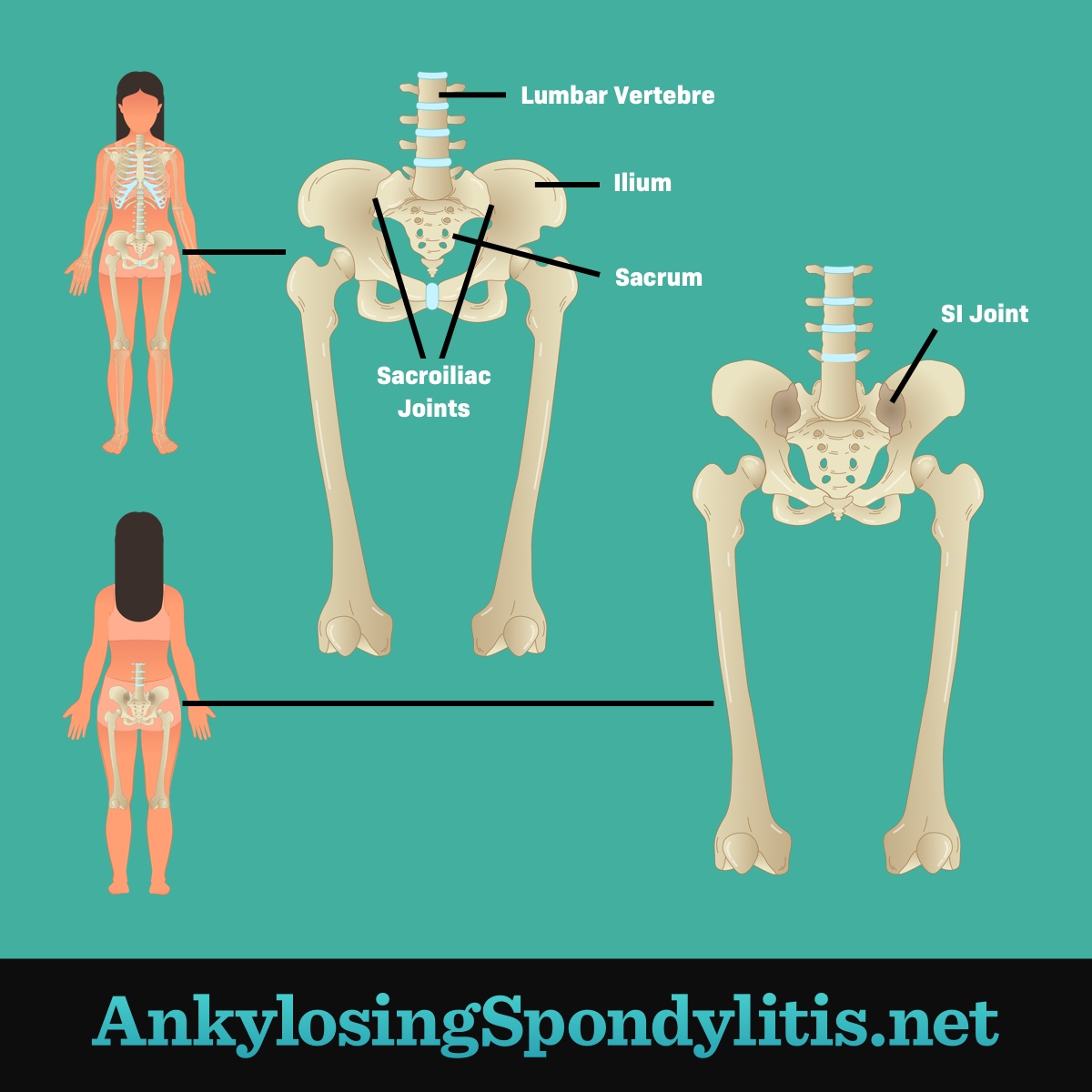 image of pelvic skeletal anatomy